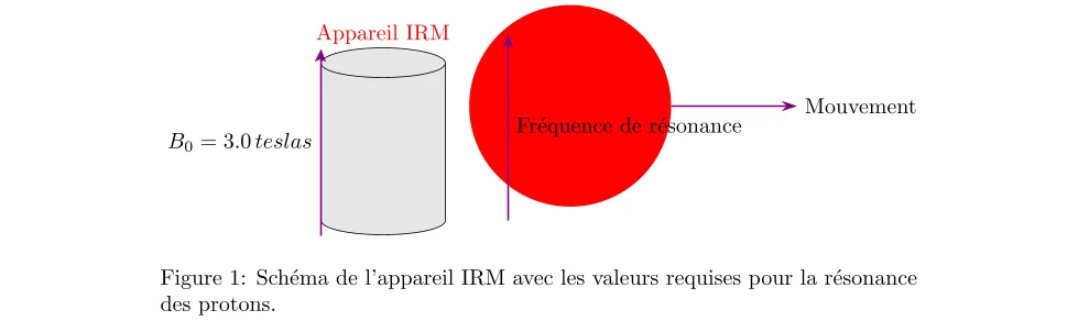 Analyse de la Fréquence de Larmor dans l'IRM